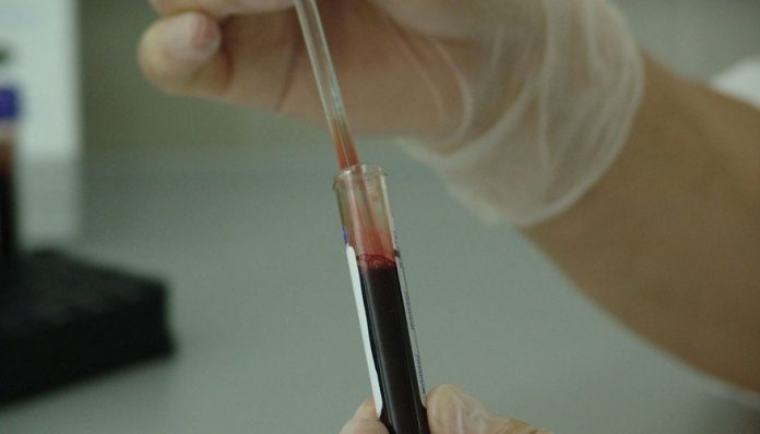 La sangre artificial ErythroMer