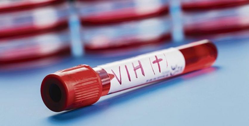 Científicos hallan una molécula que puede atenuar el virus del VIH