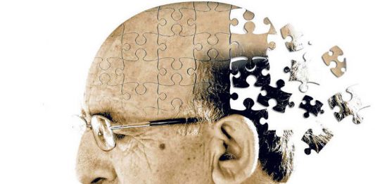 Un desequilibrio en el ph del cerebro puede ser el causante del alzheimer