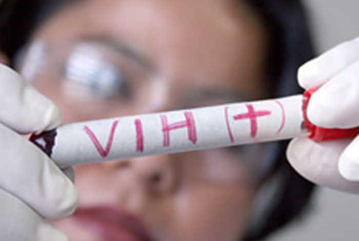Cura para el VIH finalmente están un paso más cerca