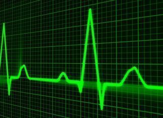 Los implantes cardíacos de Medtronic tienen una falla importante en su seguridad ¿qué deben hacer sus usuarios? los implantes cardiacos de medtronic