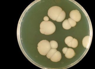 Candida auris: un hongo resistente a medicamentos está causando preocupación en el mundo Candida auris