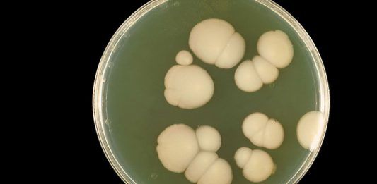 Candida auris