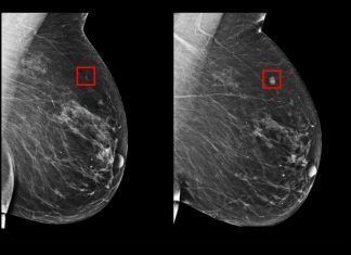 La inteligencia artificial