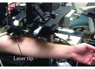Crean láser capaz de prevenir el cáncer con metástasis cáncer con metástasis