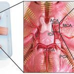 Trasplante de células madre
