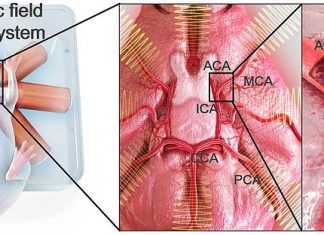 El trasplante de células madre hecho por micro-robots en un ratón Trasplante de células madre
